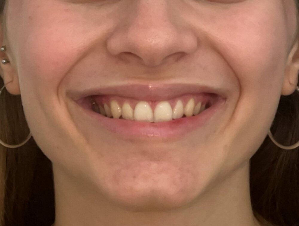 sonrası